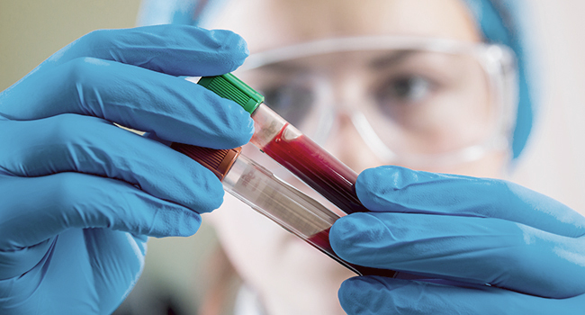 Exámenes de sangre