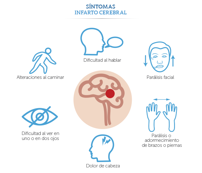 Médica Sur Sintomas De Um Acidente Vascular Cerebral Localizador