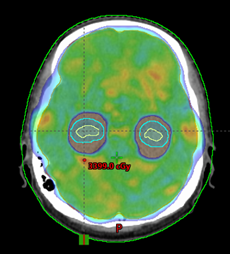 Sistema de planeación de tratamientos Eclipse v.15