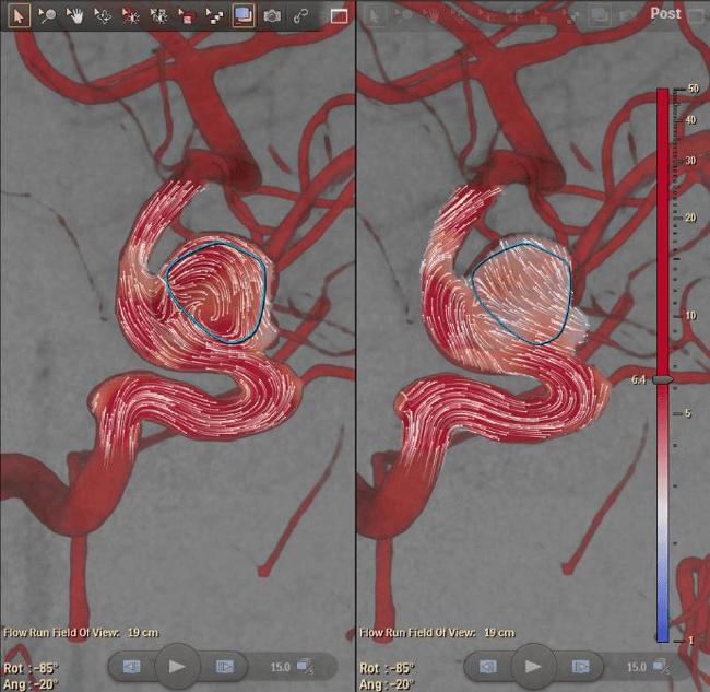 Nueva sala de hemodinamia, Tecnologa exclusiva