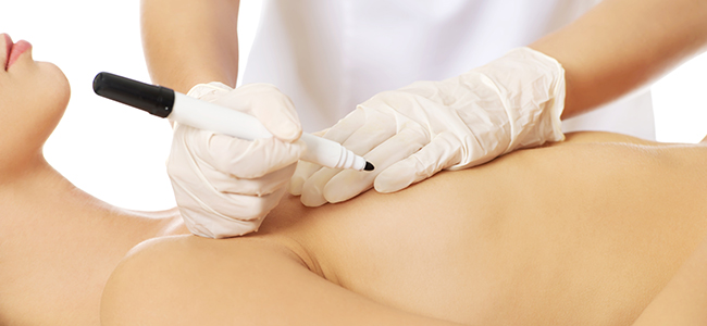 Doctora marcando líneas a paciente para cirugía estética.