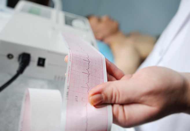 Detalle de un estudio de apnea del sueño