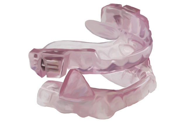 Aparato oral para apnea leve