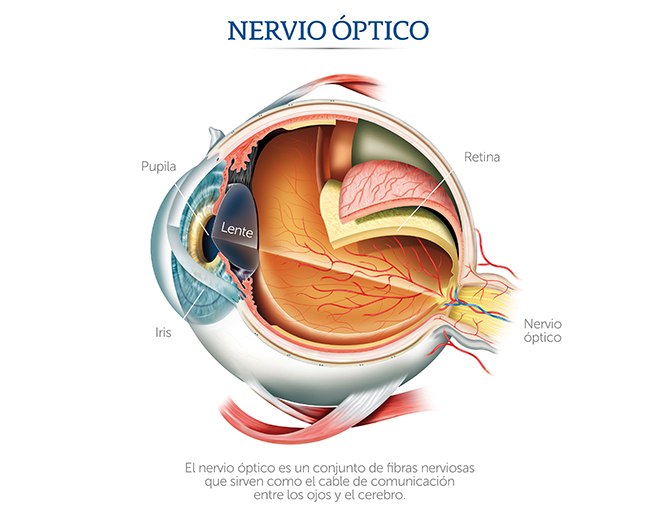 El nervio óptico en la neuritis óptica