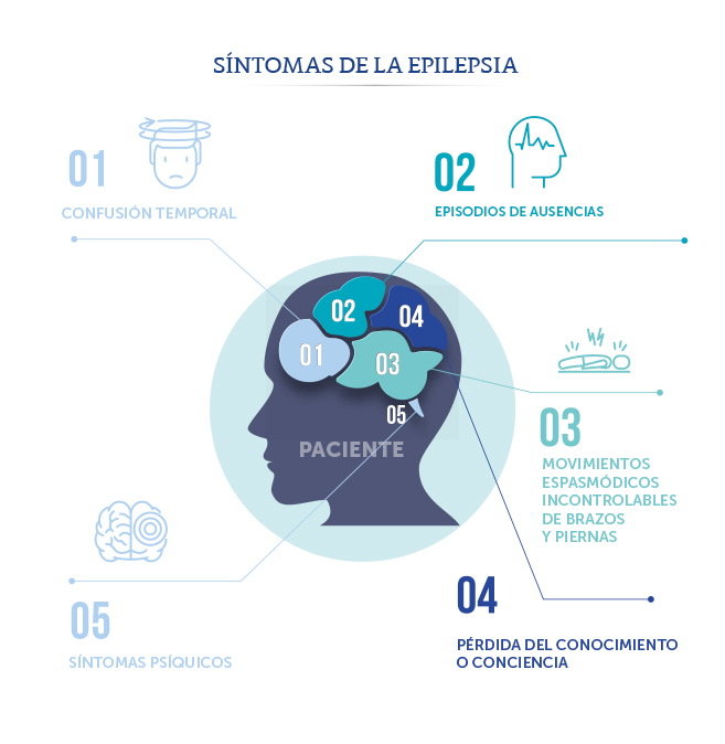 Sntomas de la Epilepsia