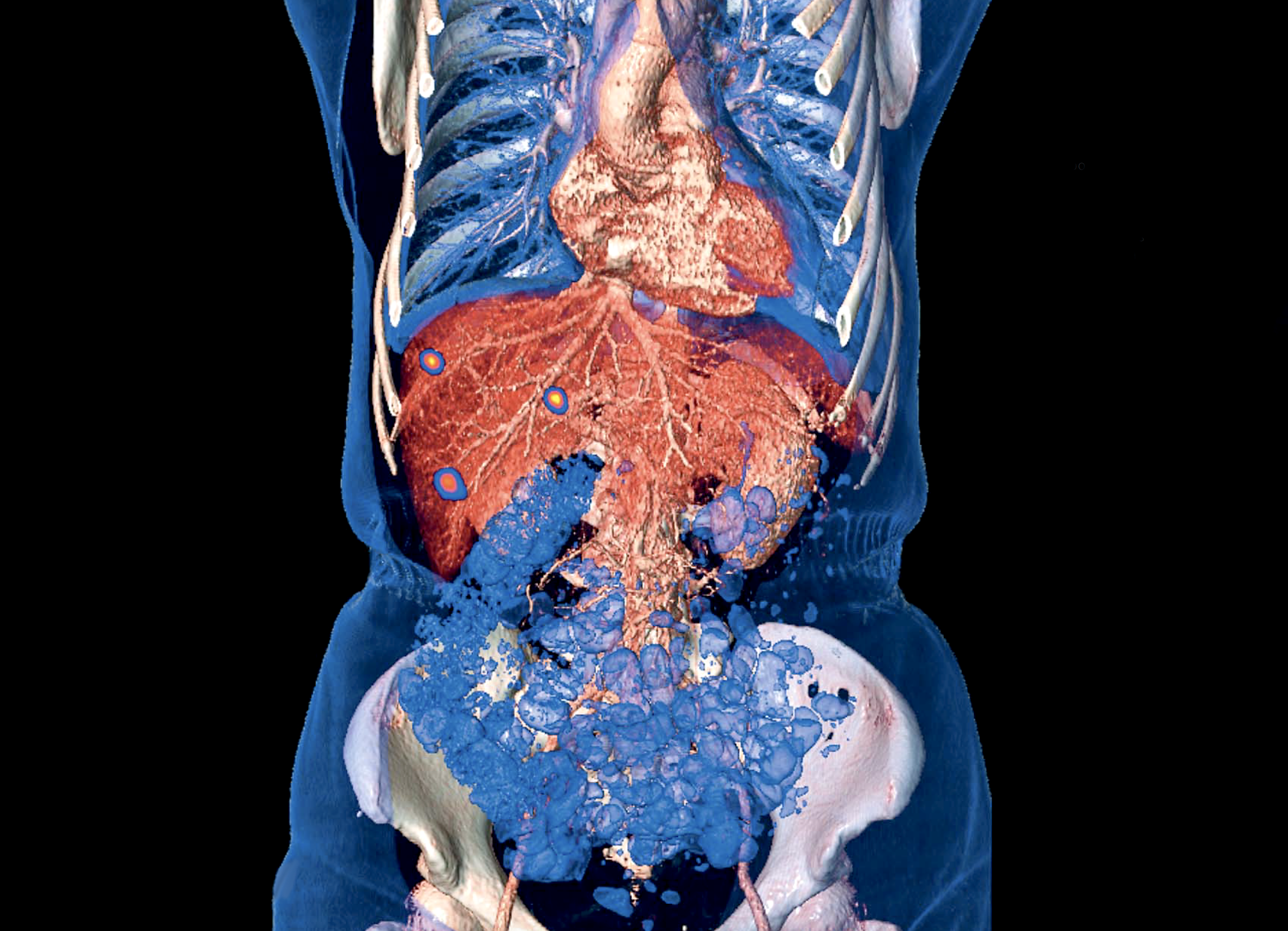 PET-CT Biograph mCT Flow<