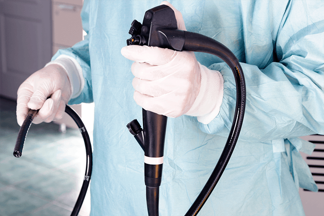 La colonoscopia funciona a través de un colonoscopio